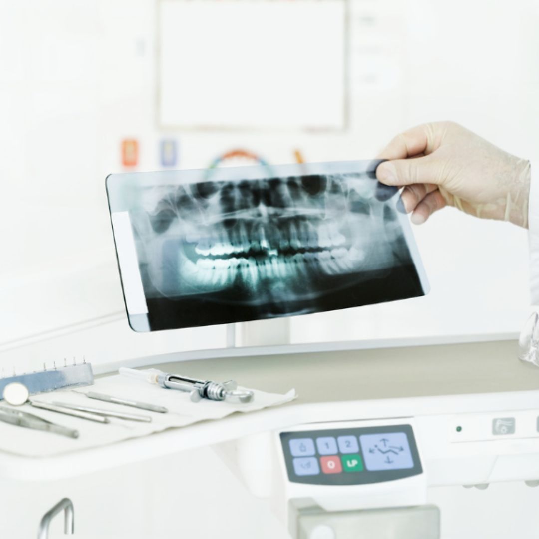 Dentist holding a dental X-ray while examining a patient’s teeth at North York Dental Clinic, with dental tools placed on a tray